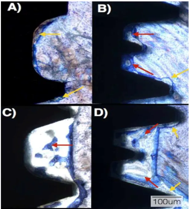 Figure 3: Optical micrographs at 2 weeks in vivo for the (a) SW recommended  instrumentation,  (b)  Unitite  recommended  instrumentation,  (c)  SW  overdrilling  instrumentation,  and  (d)  Unitite  overdrilling  instrumentation