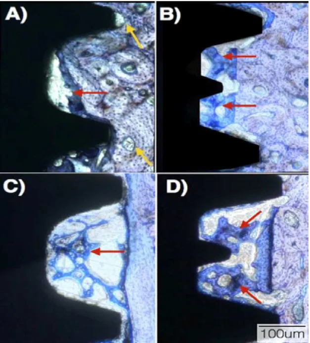Figure 4: Optical micrographs at 4 weeks in vivo for the (a) SW recommended  instrumentation,  (b)  Unitite  recommended  instrumentation,  (c)  SW  overdrilling  instrumentation,  and  (d)  Unitite  overdrilling  instrumentation