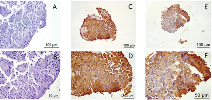Figure 7 - Immunohistochemistry. A and B) Negative control; C and D) Positive immunohistochemical staining for collagen type II;