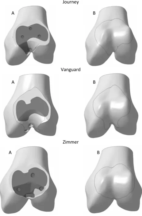 Figura 34 - Cortes ósseos no  osso esponjoso e cortical (A)  e modelo intacto (B) para cada um dos  modelos analisados