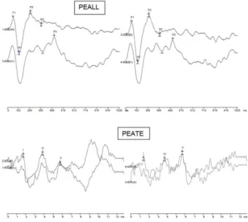 Tabela 3. Valores de latência absoluta e intervalos interpicos utilizados no PEATE