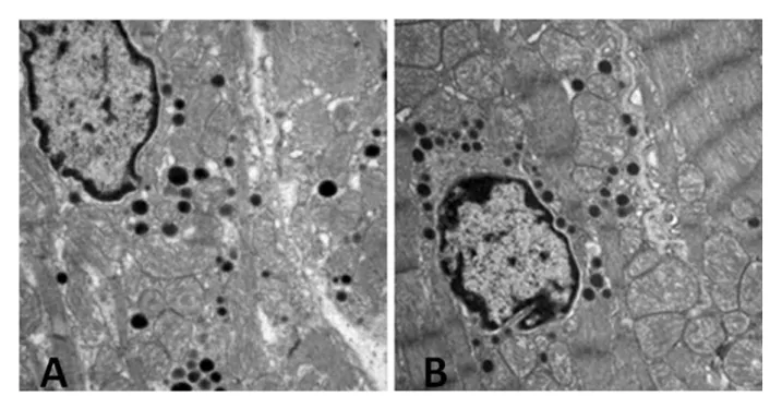 Figure 1 - Electron micrographs of atrial cardiomyocytes in the control groups. The image in (A) shows the untrained group (UC) with  plenty of interstitium with regular architecture and presence of collagen fibers
