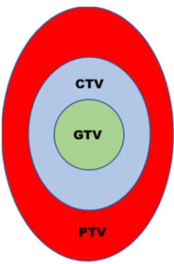 Figura 6 - Esquema standard representativo do GTV (verde), quando é expandido com margem para o CTV  (azul), para ter em consideração alguma doença microscópica