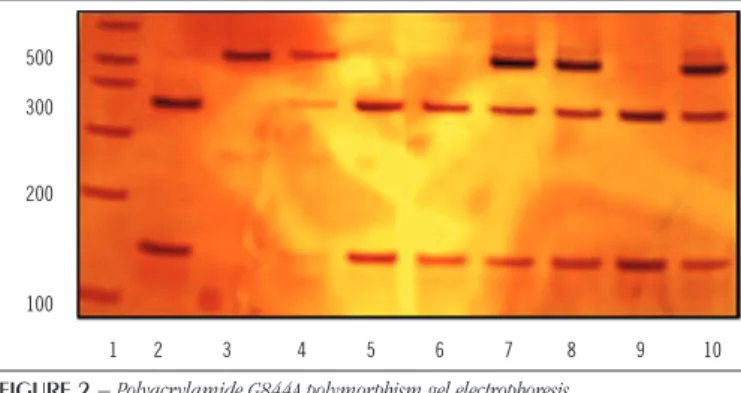 TABLE 1  − Frequency of ApoE gene polymorphisms in patients with stroke and individuals in the control group