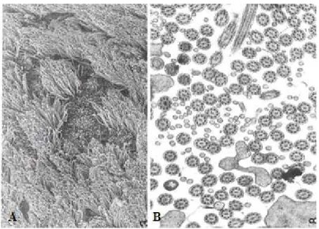 Figura 5: Imagem de cílios de epitélio respiratório em microscopia eletrónica de varredura (A) e de  transmissão (B) 