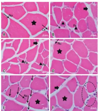 Figura 1. Microfotografia da secção transversal do músculo plantar de ratos  Wistar, coloração hematoxilina e eosina