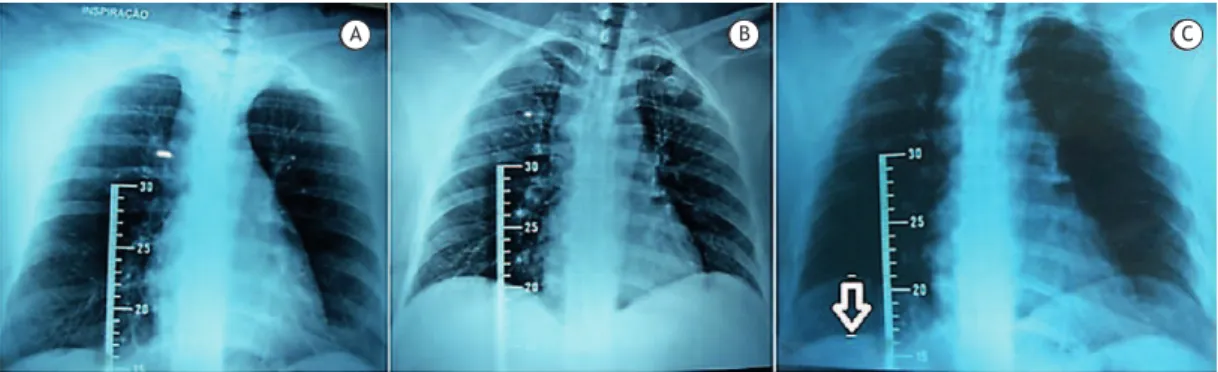 Table 1. Anthropometric characteristics and pulmonary  function variables of the study participants