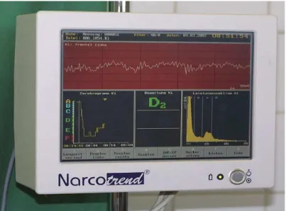 Figure  1.4  -  This  figure  corresponds  to  an  adaptation  of  Kreuer  &amp;  Wilhelm  2006  about  The Narcotrend stage, actual value and trend (‘cerebrogram’) and raw electroencephalogram (EEG)  signal, as well as a power spectrum and several derived