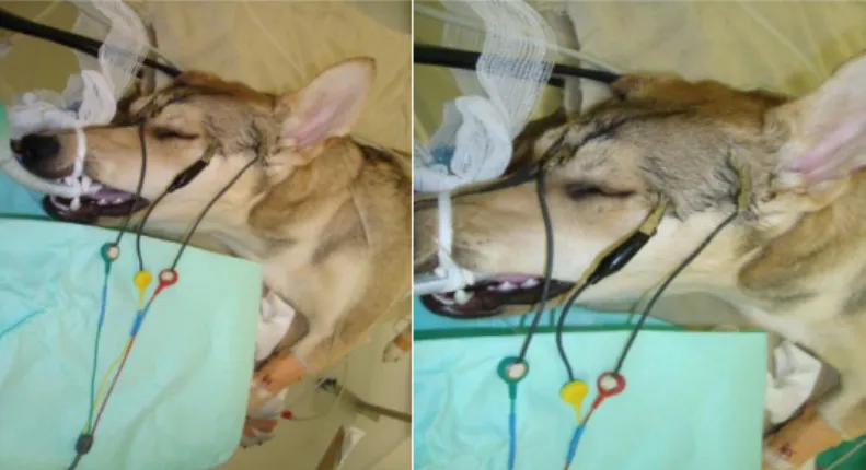 Figure  2.3  –  Representation  of  the  electrodes  placement:  in  the  middle  of  the  forehead/frontal  bone  the  positive  electrode  (+),  to  the  left  side  of  the  forehead  near  the  lateral  eye  socket  the  reference  electrode (ref), and