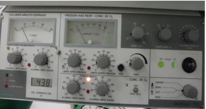 Figure 2.4 -  This picture represents the mechanical ventilator (Siemens Ventilator 710) used during this study