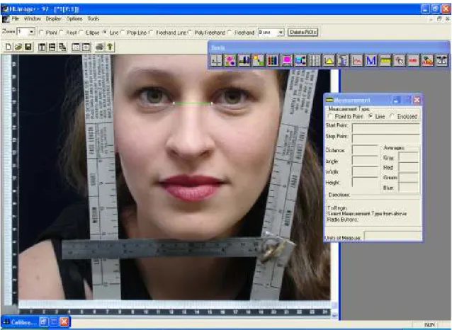 Figura  8:  Traçado  verde  entre  os  cantos  mediais  dos  olhos  (ICD)  utilizando  HL  Image  97++,  para medir a distância entre os pontos extremos de uma reta