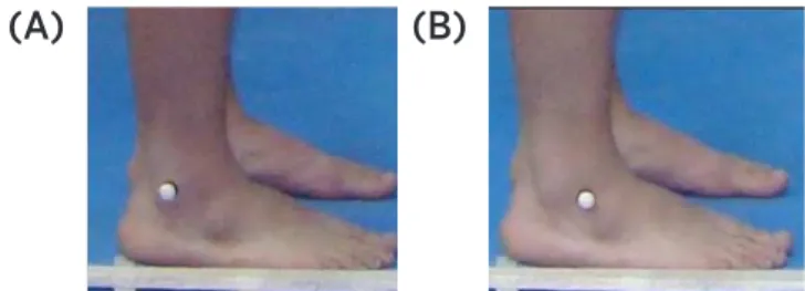 Figure 2. (A) Reference marker in the center of the lateral  malleolus; (B) Reference marker in front of the lateral malleolus.