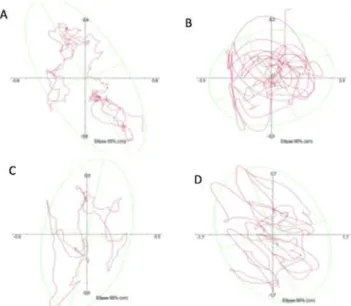 Table 2. Comparison of center of pressure variables between  groups with regard to dominant bipedal and single-leg stance