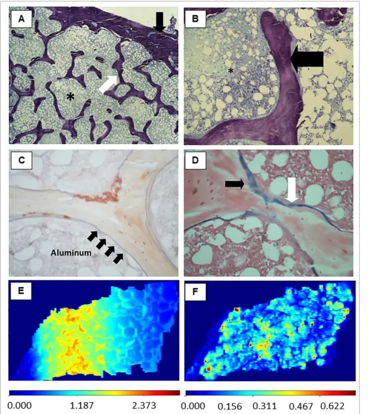 Figure 1. Representative images of bone tissue. (A) Thin cortical and trabecular bone with an increased trabecular separation (x40 magnification)