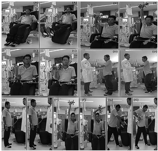 Figure 2. Initial proposal of a resistance training protocol for patients on hemodialysis