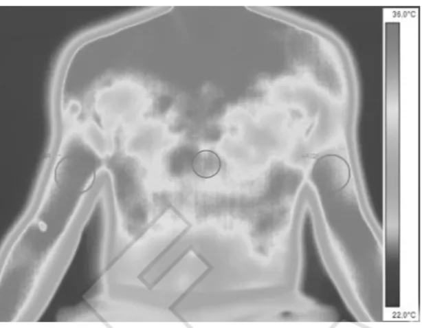 Figure 1.—illustration of thermal images analysis where the  circles indicate the rois.