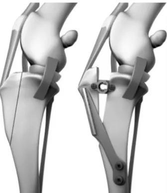 Figura 4: Posicionamento da osteotomia e representação  esquemática  da  técnica  TTA  (adaptado  de  Kim  el  al.,  2008)
