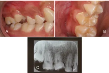 Figure 2. Intraoral image: Seventh post-operative day.