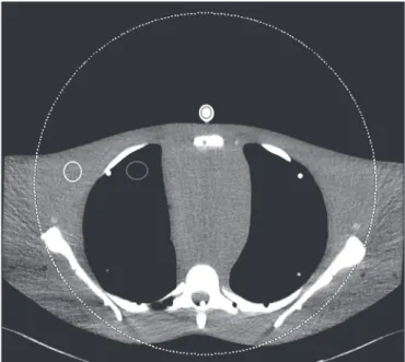 Figure 1. Transverse CT image of the anthropomorphic thoracic phantom. 