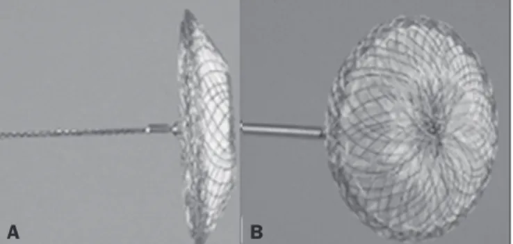 Figure 1. The Occlutech Figulla ASD N device. A: Lateral view. B: Frontal view.