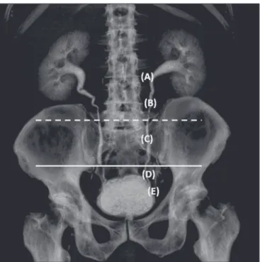 Figure 2. Three-dimensional reconstruction of an MDCT examination of the  urinary tract