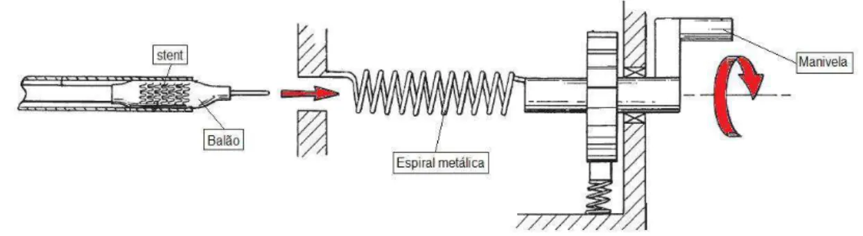 Figura 2.10 - Montagem do stent e do balão na ferramenta de crimpagem (MORALES, 1999)