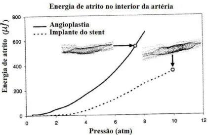 Figura 2.18– Predição da energia de atrito na parede arterial para a angioplastia por balão e  para a colocação do stent (LAROCHE et