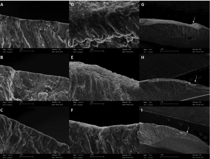 Figure 3-  Electron micrographs of the enamel. The images were obtained via scanning electron microscopy at 7.500x (A, B, C, D, E, F)  and 100x (G, H, I) magnifications