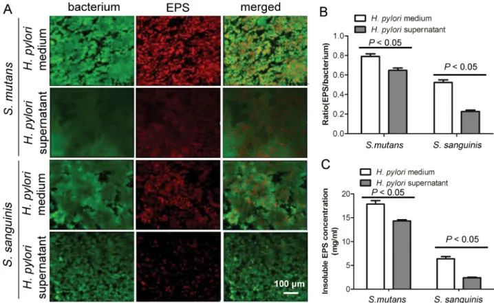 Figure 5-   Effect  of  H. pylori   supernatant  on  bacteriocin-  and  acidogenicity-related  genes  expression  of  S