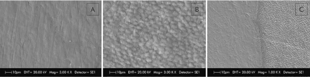 Figure 1-  Representative images of scanning electronic microscopy. A- Sound enamel; B- Eroded enamel; C- Image shown the erosive  effect only on the surface that did not receive the composite resin as insulation material