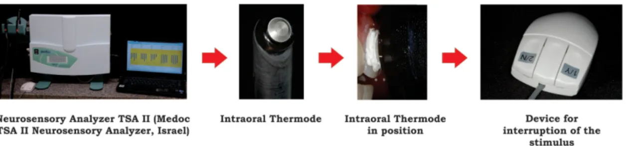 Figure 2- Scheme of the neurosensory analysis using the equipment TSA II