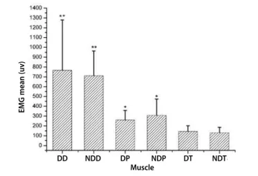 Figure 4. Values expressed in RMS (μν) of the electrical activity of the dominant  deltoid (DD), non-dominant deltoid (ND), dominant pectoralis (DP), non-dominant  pectoralis (NDP), dominant triceps ( ) and non-dominant triceps (NDT)muscles of the  11 swim
