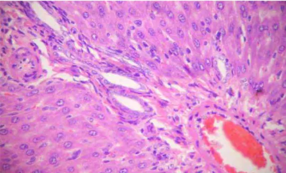 Figura 5. Fotomicrografia do fígado de rata prenhe com pré-eclâmpsia induzida por L- L-NAME, apresentando infiltrado periportal moderado