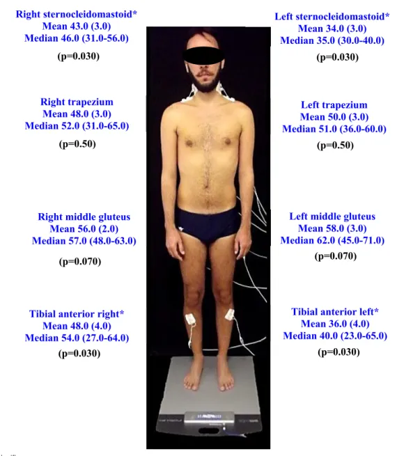 Illustration 1.  Pictogram  of  means  (standard  errors  of  means)  and  medians  of  the  electromyographic  potentials  according  to  right  chewing preference.                    Right sternocleidomastoid* Mean 43.0 (3.0) Median 46.0 (31.0-56.0) Righ