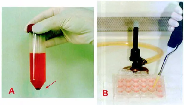 FIGURA 8 - Preparo de cultura de linfócitos B: A) células do  baço sedimentadas  em  meio RPMI; B)  placa de cultura de células contendo de linfócitos  B