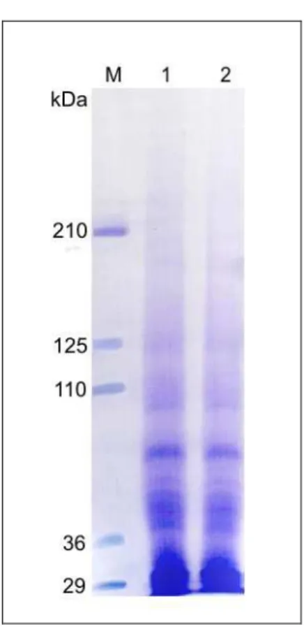 Figura  8:  Gel  SDS-PAGE  para  análise  das  proteínas  intestinais  extraídas  de  larvas  de  Diatraea  saccharalis