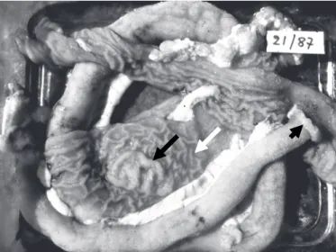 Fig. 1. Íleo mais firme com parede espessada (cabeça de seta);