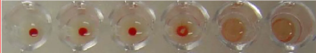 Figura 10- Foto da microplaca demonstrando o teste de IH com diluição ao  dobro do soro, iniciando pela diluição 1:20