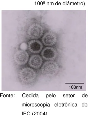 FIGURA  1-  Micrografia  eletrônica  de  extrato  fecal  contendo  partículas  completas  de  RV   (75-100º nm de diâmetro)