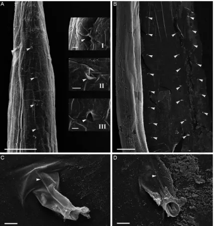Fig. 3: scanning electron microscopy of Rhabdias paraensis sp. nov. A: anterior end of the body showing external surface of cuticular swelling  and insertion points (arrowhead)