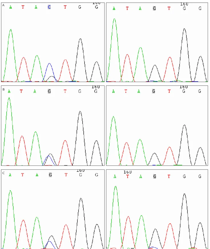 FIGURE 2   A. -3148 site genotype in STEMI collateral circulation group. B. -3148 site genotype in STEMI non-collateral circulation group