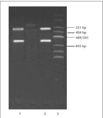 FIGURE 5   Result of total RNA electrophoresis extracted from  endometrial tissues.