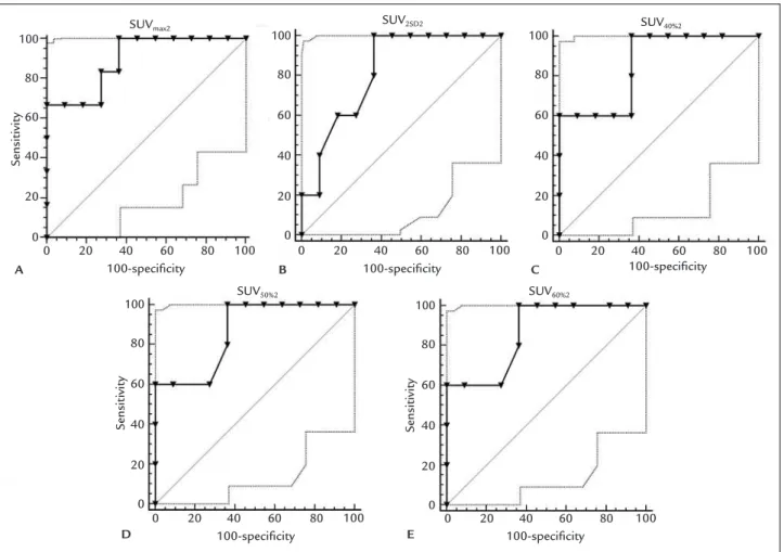 FIGURE 3   Typical example of  18 F-FDG PET/CT image tumor segmentation using 2SD individualized algorithm