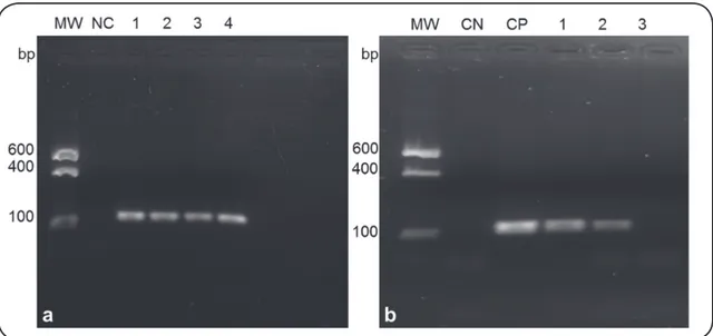 FIGURE 2: Amplification of DNA extracted from the samples at a concentration of 10 3  CFU/ml using protocol 5