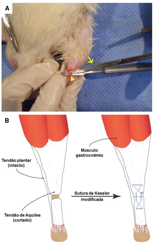 Figura 4 .  Procedimento de ruptura cirúrgica e sutura do tendão de Aquiles. Em A, notar  o  isolamento  do  tendão  (cabeça  de  seta)  e  o  momento  de  ruptura  cirúrgica  com  a  tesoura  (seta)