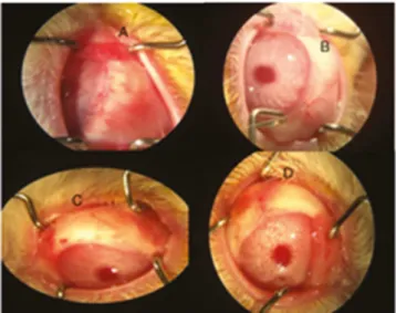 Figure 3. Polymorphonuclear count throughout the  study; p1: comparison between groups in each phase; p2: 