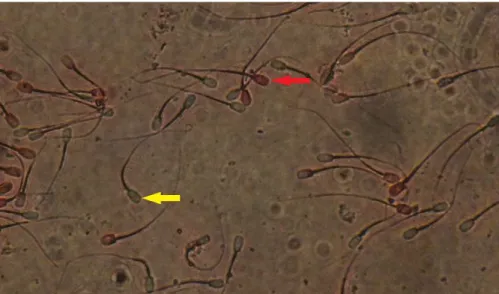 Figura 1 – Imagem da técnica de avaliação de integridade de membrana plasmática  em sêmen in natura de touros bubalinos (Bubalus bubalis) por coloração supravital  por  eosina-nigrosina  (seta  vermelha  –  espermatozoide  com  membrana  plasmática  lesada
