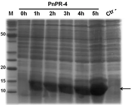 Figura 5. SDS-PAGE dos extratos protéicos total de células (E. coli Rosetta (DE3)) transformadas com a  construção plasmidial  (pET29a+PnPR-4), com expressão induzida nos tempos de 0h, 1h, 2h, 3h, 4h e 5h,  e  vetor  vazio  controle  negativo  (CTR-)