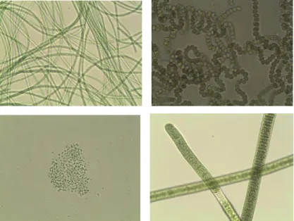 Figura 1: Diversidade Morfológica de cianobactérias: Morfologia filamentosa (acima) e unicelular (abaixo  a esquerda)