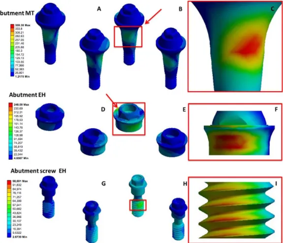 Figure 4. Distribution of stress concentration on prosthesis screws. A. MT-m; B. MT-pm; C